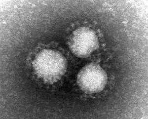 MERSコロナウイルスの電顕写真