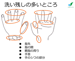 洗い残しの多いところの図