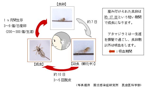 自然 に 治る アタマジラミ