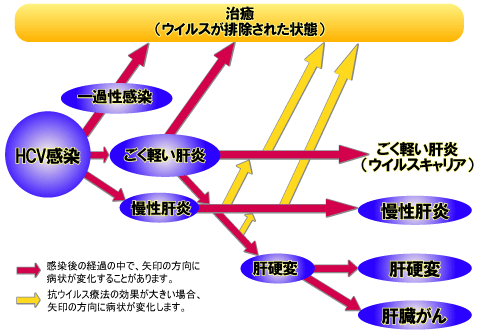 感染 c 型 経路 肝炎