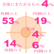 乳がんができやすい場所のグラフ（外側の上53％、内側の上19％、外側の下14％、内側の下6％、乳頭4％）